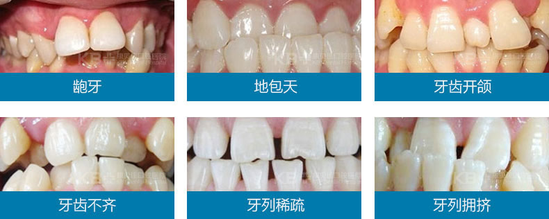 武汉又有大动作缺牙牙不齐的居民快来看这笔补贴有多实惠ob体育